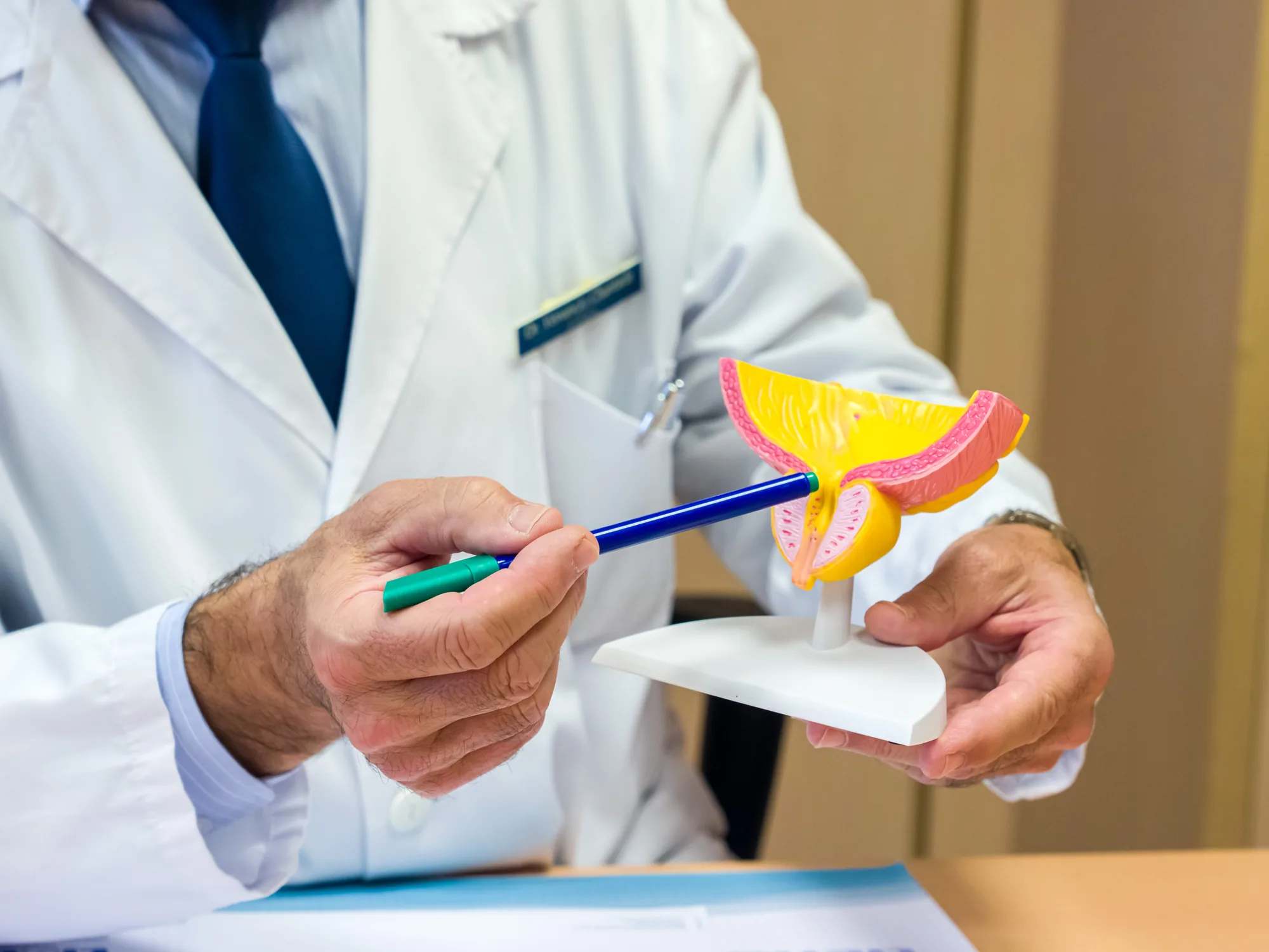 Diagnóstico y tratamiento del cáncer de vejiga